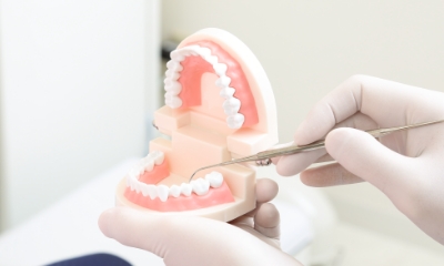 予防歯科（定期健診）